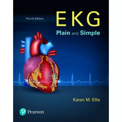 EKG Plain and Simple