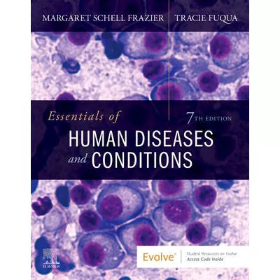 Essentials of Human Diseases and Conditions